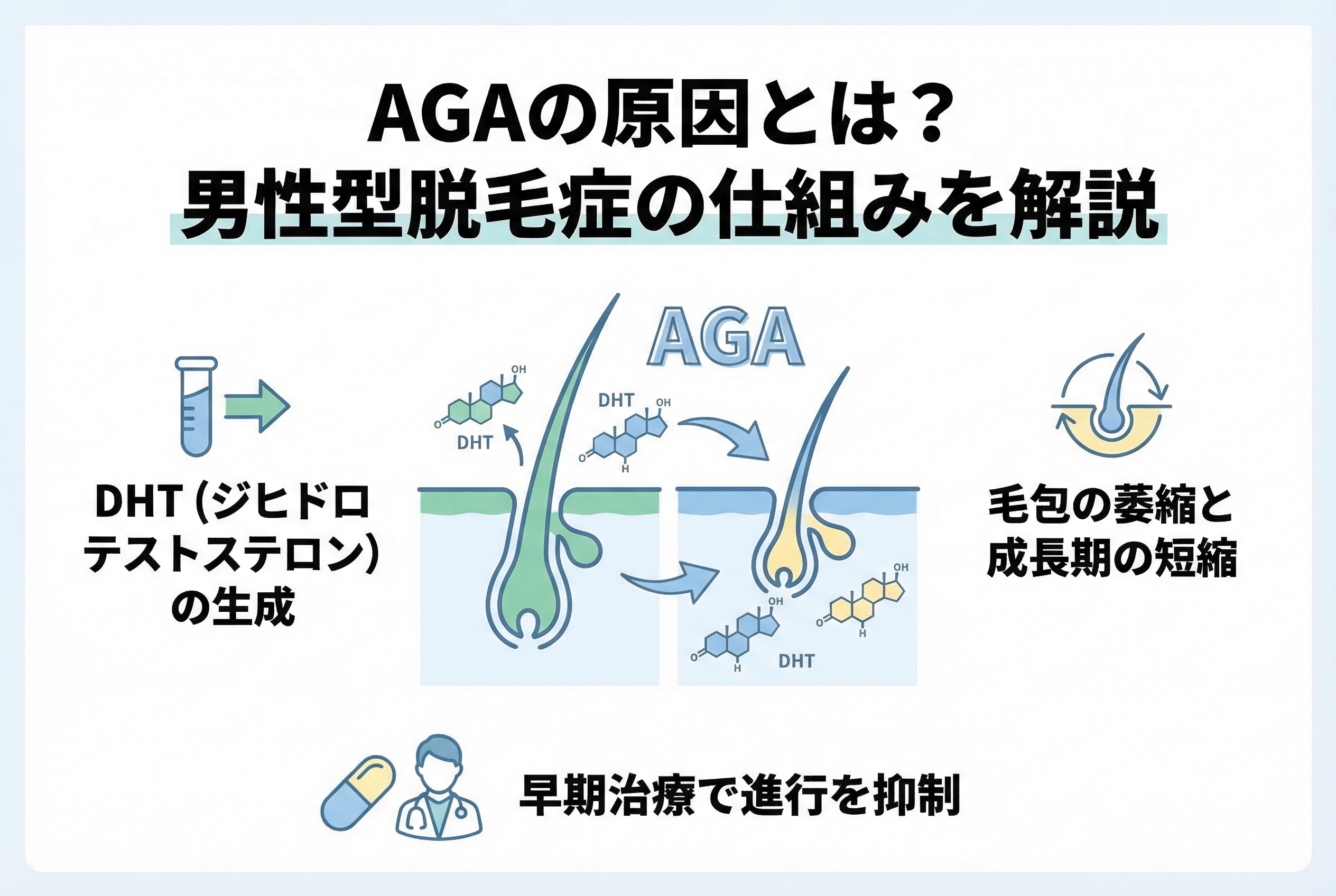 AGAの原因と仕組み