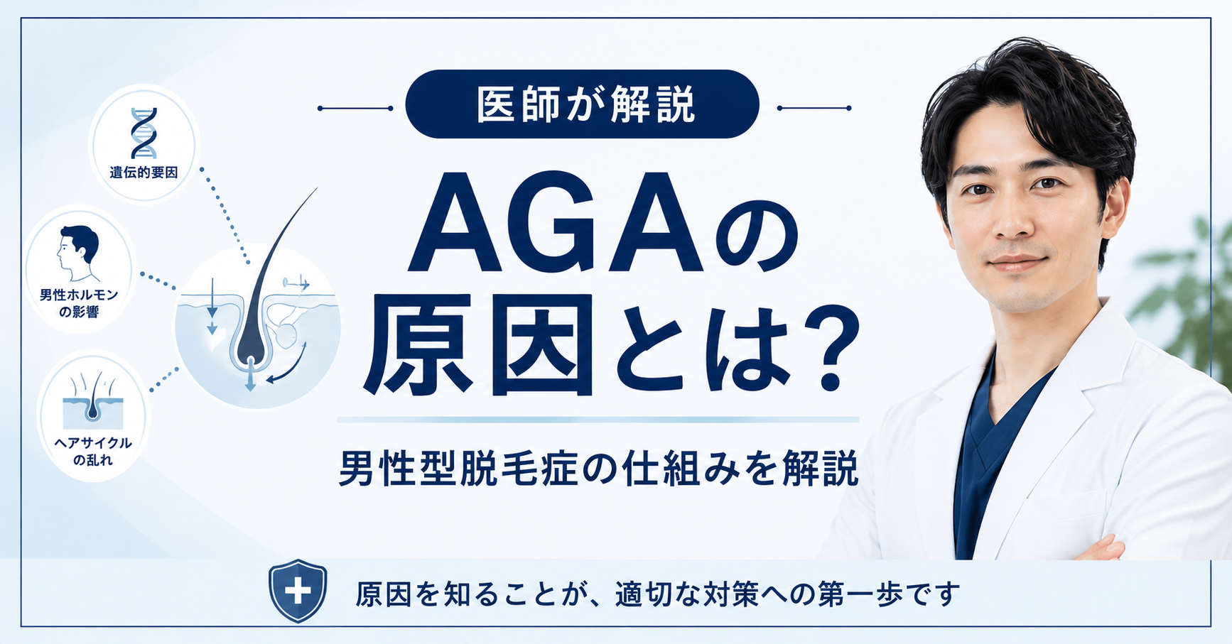 AGAの原因と仕組み