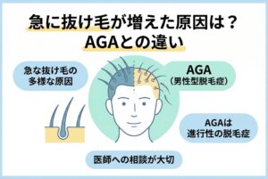 急に抜け毛が増えた原因とAGAの違い