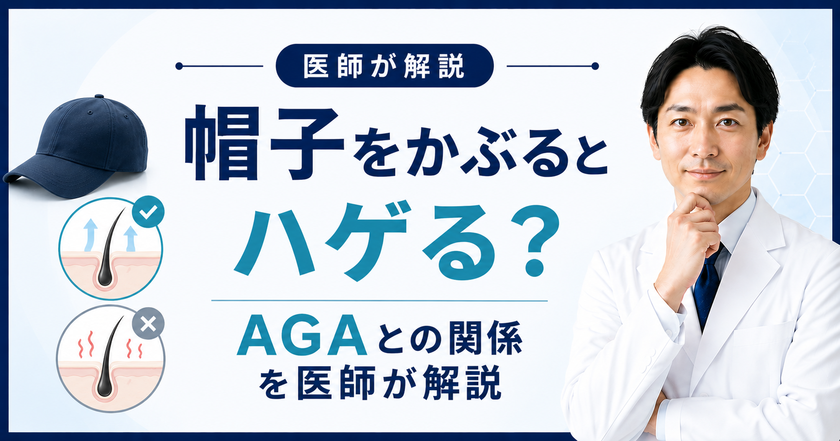 帽子と薄毛・AGAの関係を解
