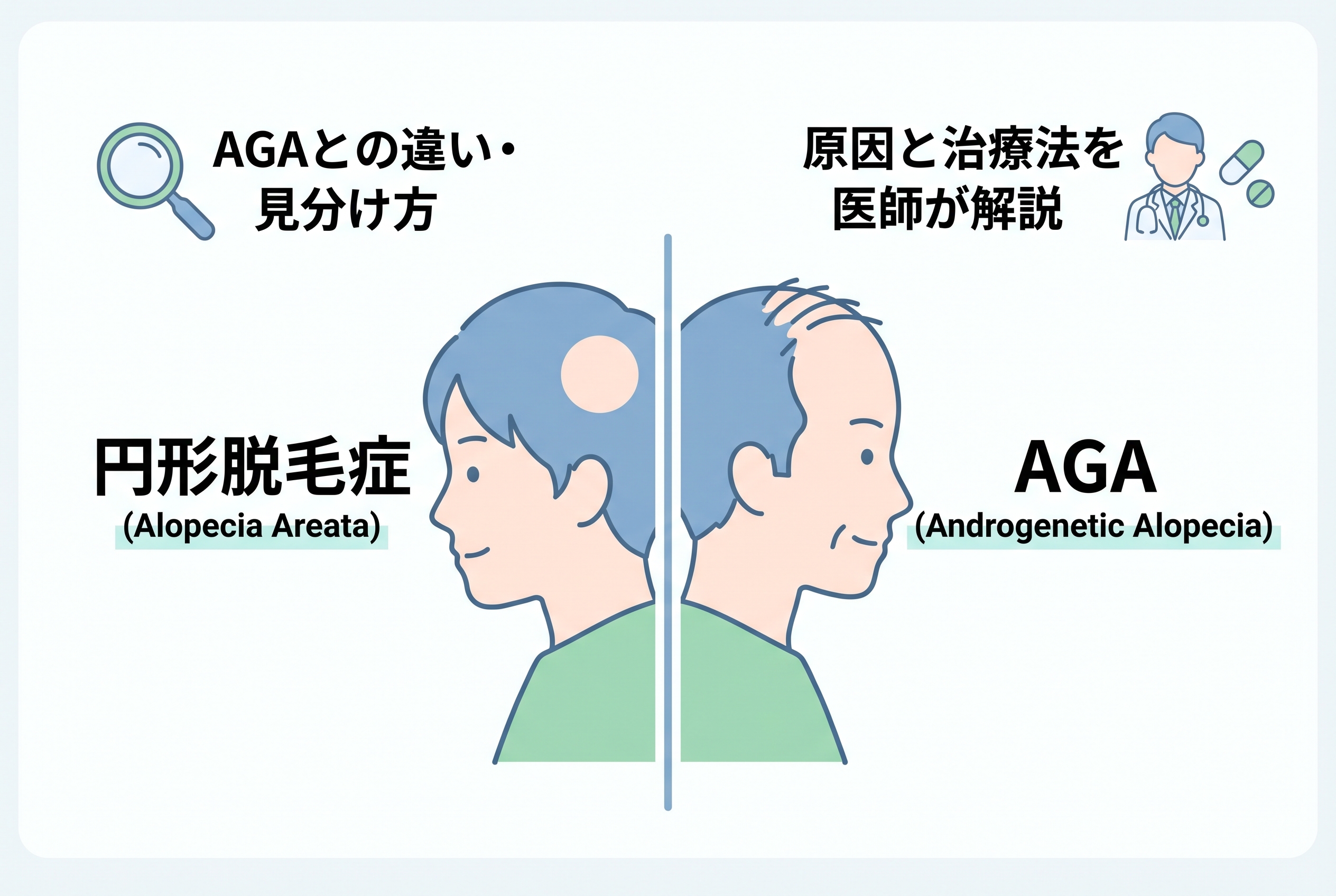 円形脱毛症のイメージ