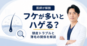 フケと薄毛の関係